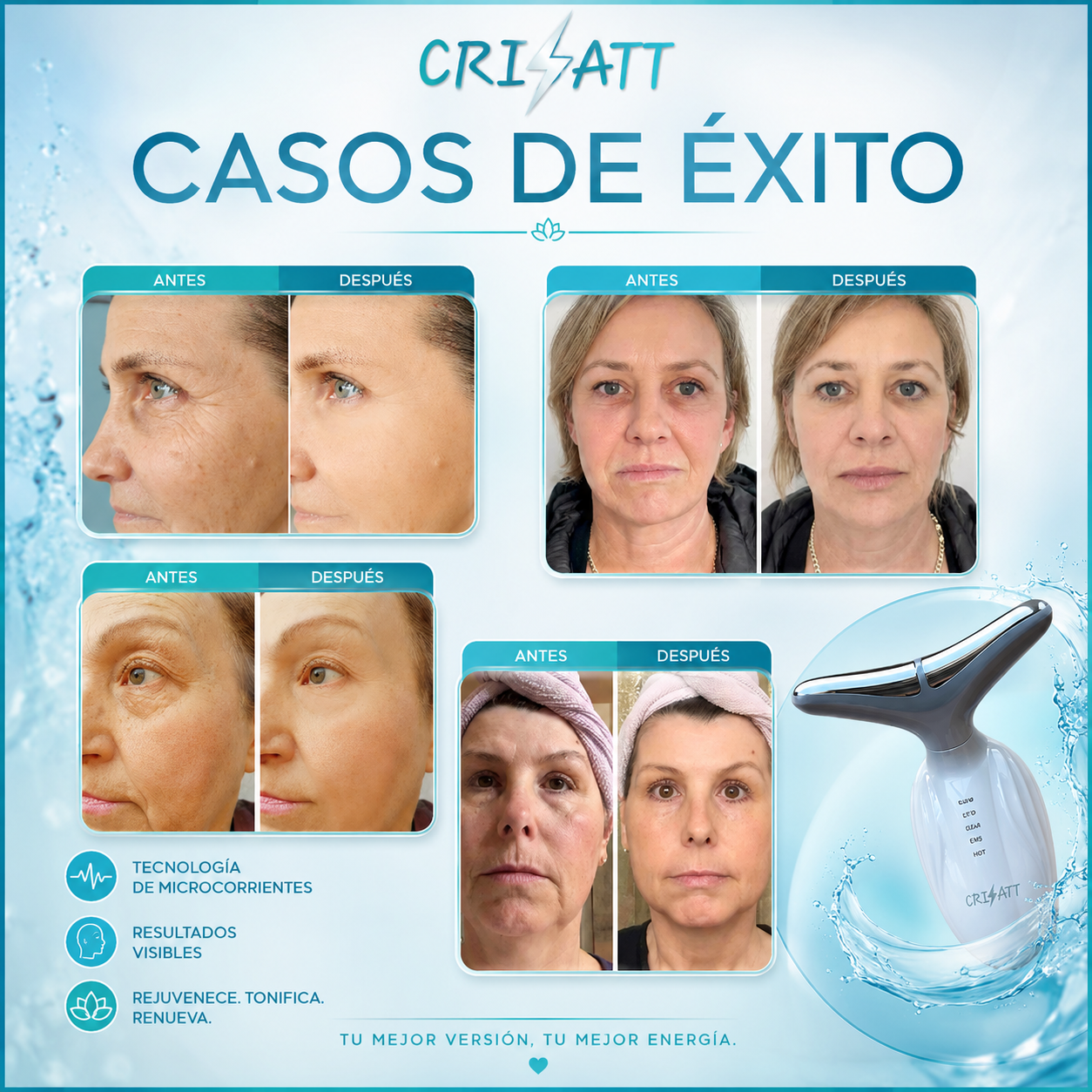 MasajeadorLED |Rejuvenece en semanas, adiós papada| glowATT ™