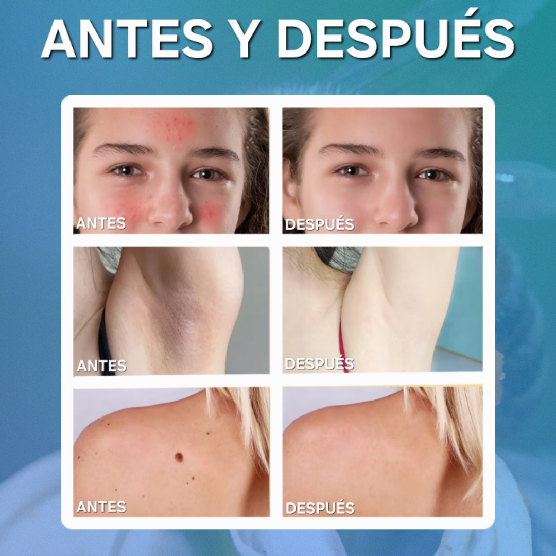 Crema reparadora de veneno de abeja 60g|beevATT™