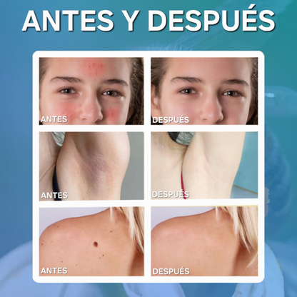 Crema reparadora de veneno de abeja 60g|beevATT™