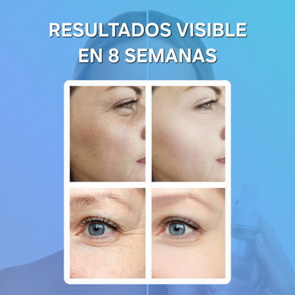 Parches solubles colágeno y ácido hialurónico |PIEL FIRME EN MINUTOS| xausATT™