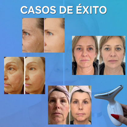 Masajeador con LED |Adiós papada y rejuvenece. En semanas| glowATT ™